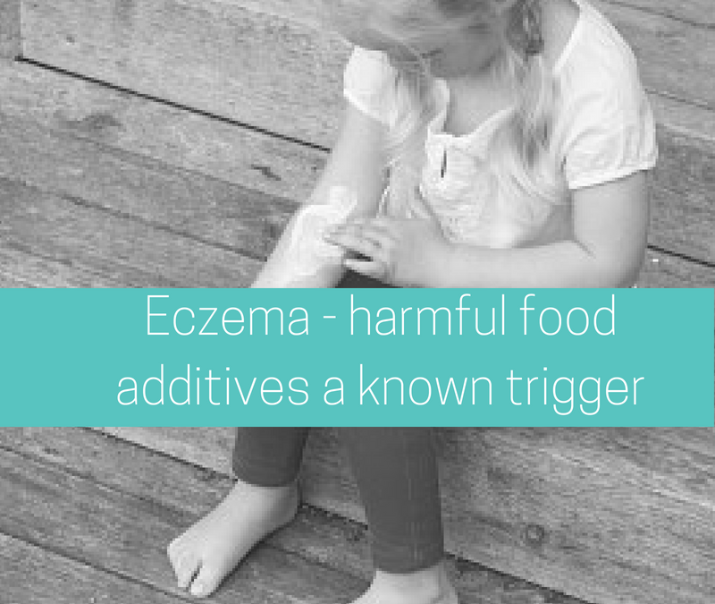 Eczema- harmful food additives known trigger